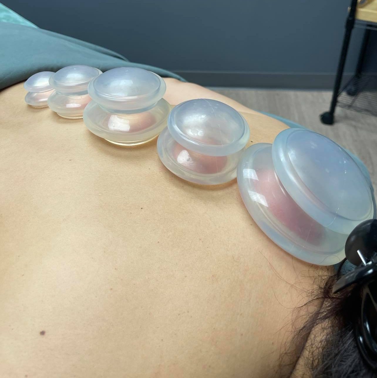 st albert massage | myofascial treatment on back