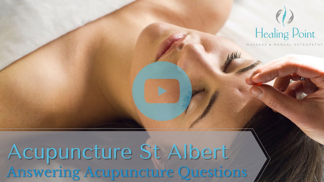 Acupuncture St Albert